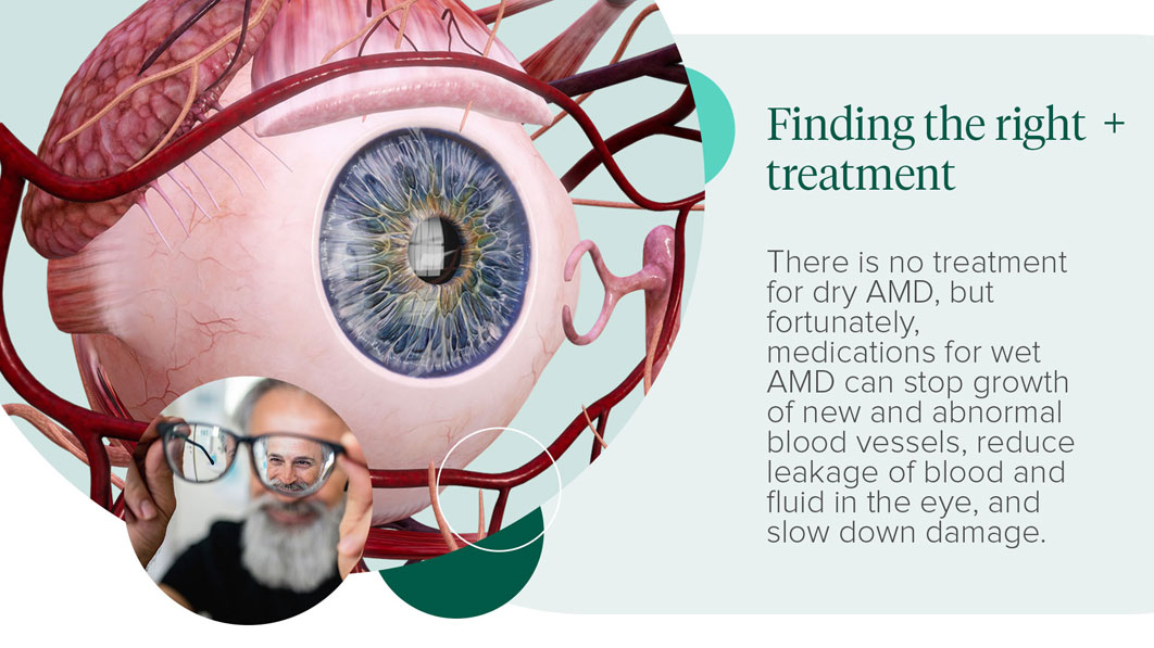 Finding the right treatment