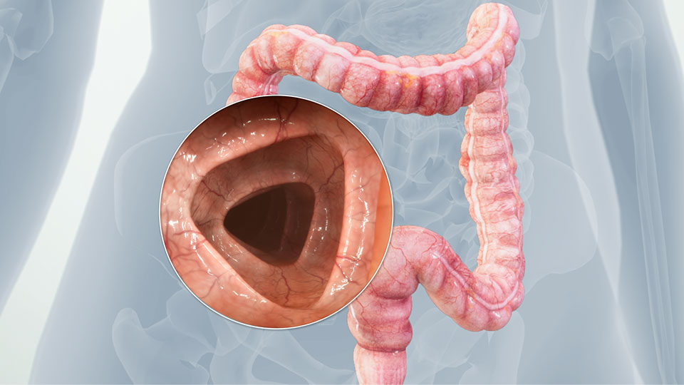 Healthy Colon